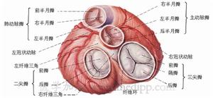 心肌梗塞並發左心室室壁瘤