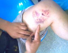 飼養動物損害責任 飼養動物損害責任