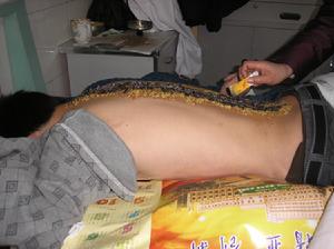 風濕骨痛 風濕骨痛