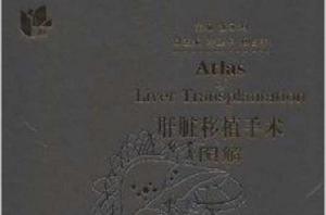 肝臟移植手術圖解 肝臟移植手術圖解