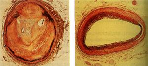 人類基因組計畫