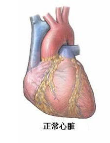 心臟移植 心臟移植