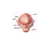 女性膀胱頸梗阻 女性膀胱頸梗阻