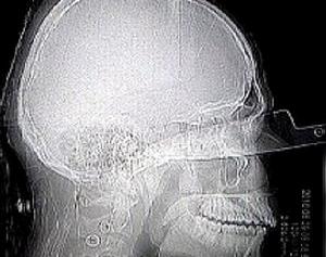 傑德·托里斯·莫塔 傑德·托里斯·莫塔