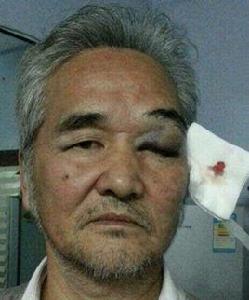 9·17成都社區工作人員打人事件 9·17成都社區工作人員打人事件