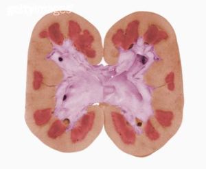 老年慢性腎功能衰竭 老年慢性腎功能衰竭