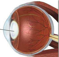 凝脂翳病 凝脂翳病