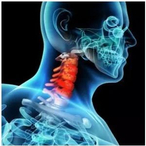 脊髓半切綜合症 脊髓半切綜合症