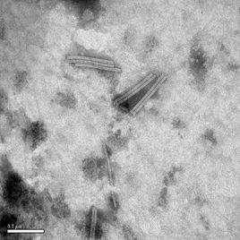 桿狀病毒表達系統