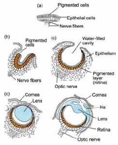 無晶狀體 無晶狀體