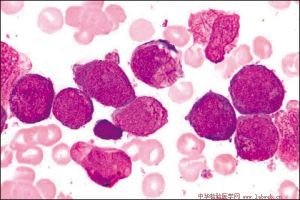 棒狀小體 棒狀小體