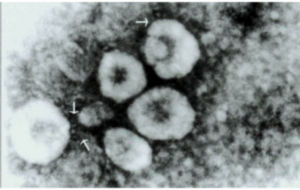 馬傳染性支氣管炎 馬傳染性支氣管炎