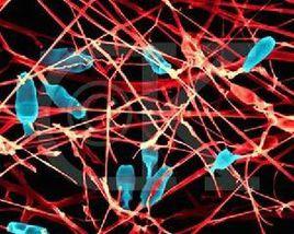 先天性卟啉症 先天性卟啉症