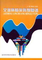愛滋病臨床病例圖譜 愛滋病臨床病例圖譜