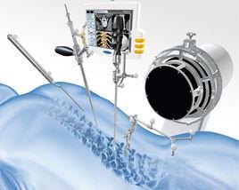 微創治療 微創治療