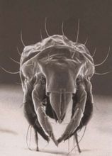 顯微鏡下的蟎蟲