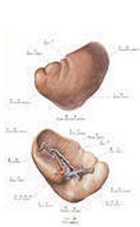 脾虛濕困 脾虛濕困