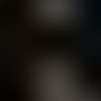 IC 1852 RASS 彩色圖