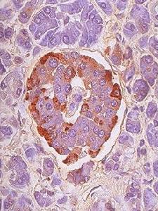 單組分豬胰島素