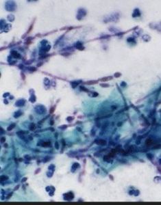 絲狀真菌[黴菌]