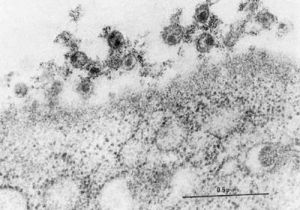 病毒吸附蛋白 病毒吸附蛋白