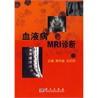 血液病MRI診斷