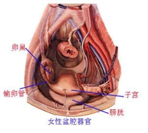 盆腔炎
