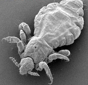 布氏錐蟲病 布氏錐蟲病