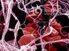 纖維蛋白溶解系統 纖維蛋白溶解系統