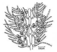 赫勃對絲藻的藻體中部，示四分孢子囊