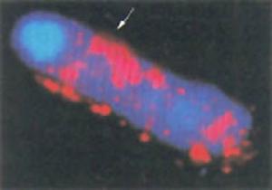 （圖）表觀遺傳學