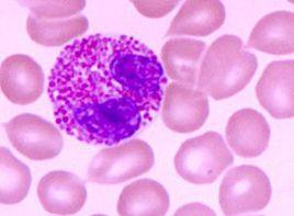 嗜酸細胞增加 嗜酸細胞增加