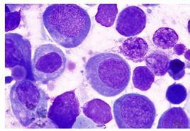 精母細胞 精母細胞