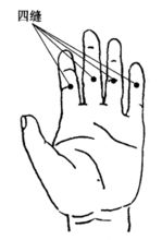 小兒疳積的刮痧療法