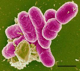志賀氏菌屬 志賀氏菌屬