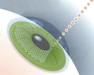 飛秒雷射 飛秒雷射