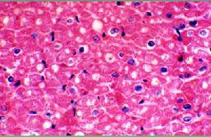 大腸埃希桿菌性胃腸炎 大腸埃希桿菌性胃腸炎