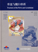 骨盆和髖臼骨折治療