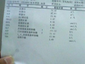 丙氨酸氨基轉移酶檢測