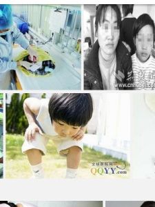 先天性腎上腺皮質增生症