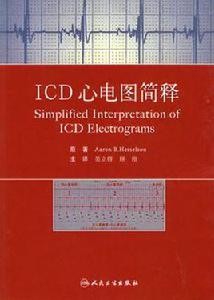 ICD心電圖簡釋
