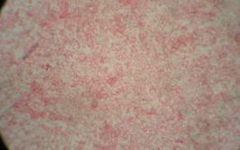 大豆根瘤菌 大豆根瘤菌