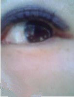 眼睛紅腫 眼睛紅腫