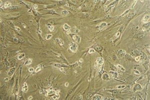 靶向性細胞再生療法 靶向性細胞再生療法