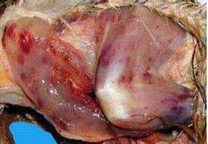 雞傳染性法氏囊病 雞傳染性法氏囊病