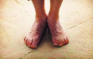 萊茵霍爾德·梅斯納爾