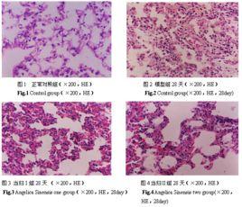 瀰漫性肺間質纖維化症 瀰漫性肺間質纖維化症