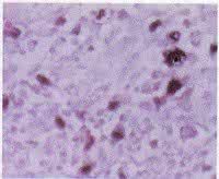 霍特加氏細胞 霍特加氏細胞