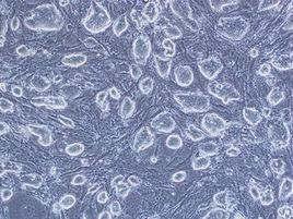 飼養層細胞 飼養層細胞