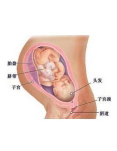 胎位頭位 胎位頭位